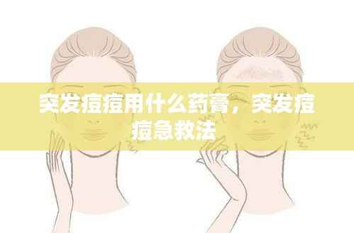 突发痘痘用什么药膏,突发痘痘急救法