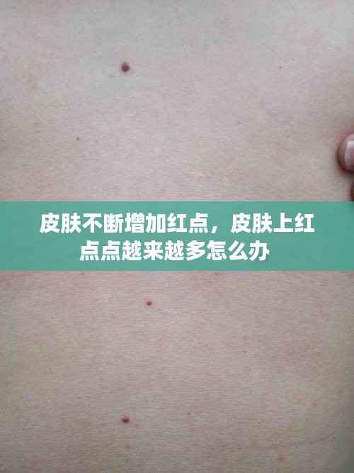 皮肤不断增加红点,皮肤上红点点越来越多怎么办