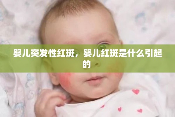 婴儿突发性红斑,婴儿红斑是什么引起的